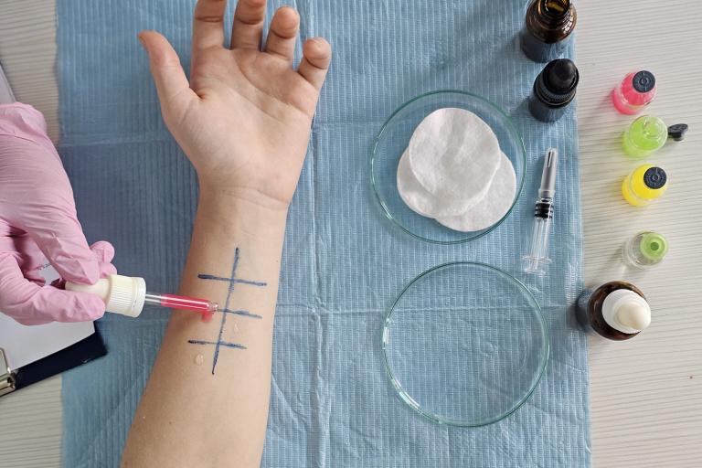 The inside of a person's forearm has been marked into a grid to test different allergens.